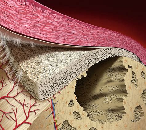 henderson bone regeneration